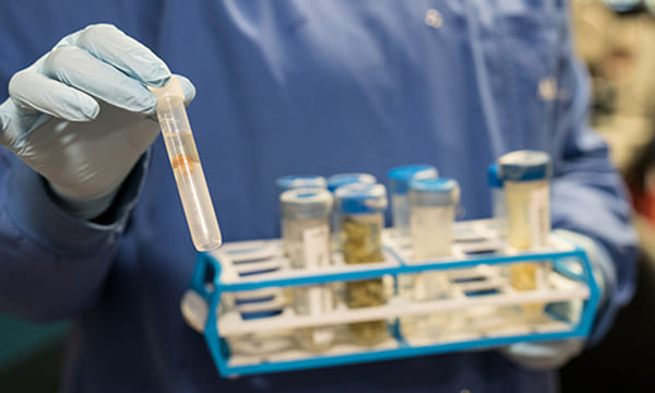 Laboratory Service Parasitology